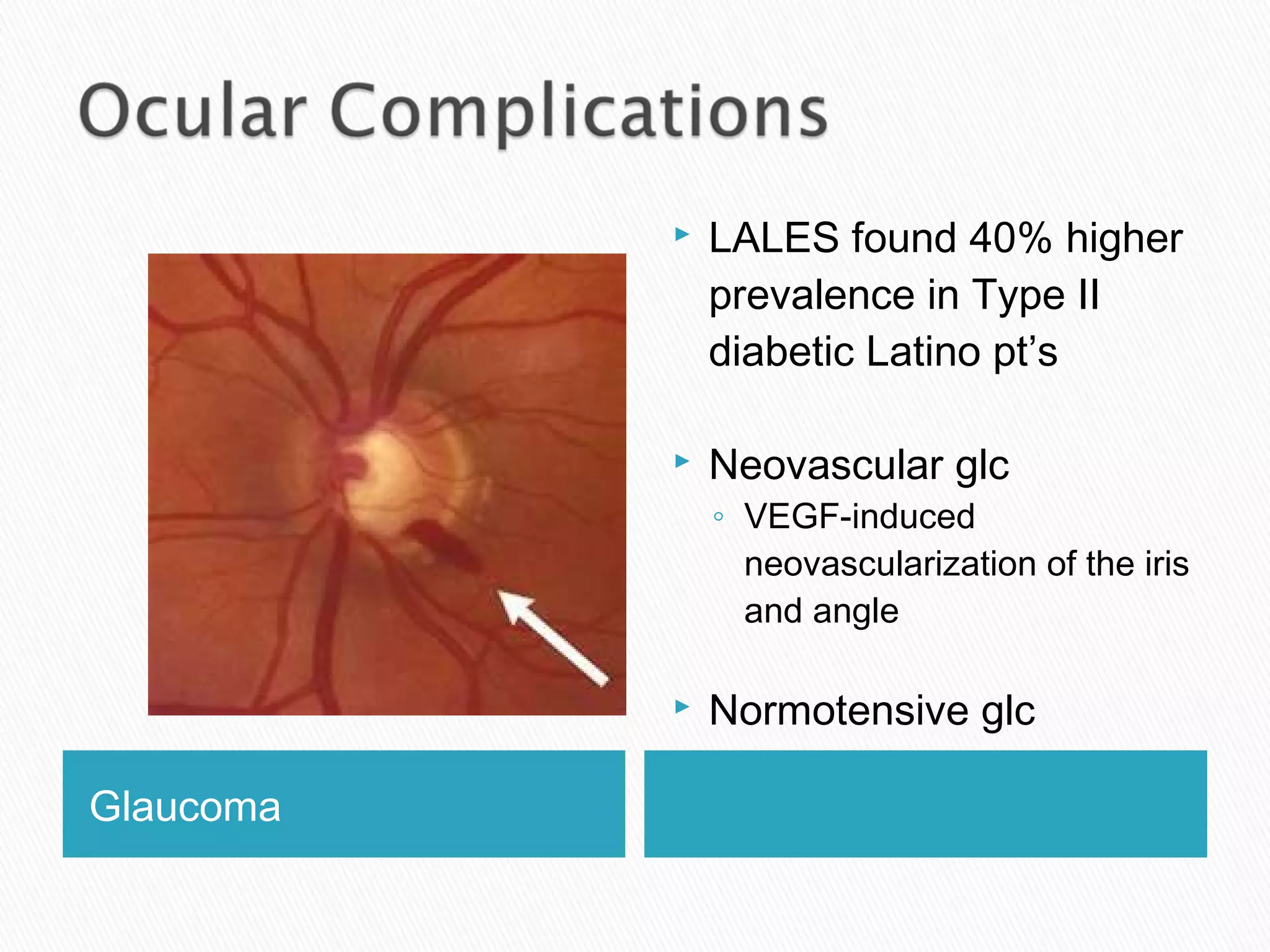 Glaucoma
 LALES found 40% higher
prevalence in Type II
diabetic Latino pt’s
 Neovascular glc
◦ VEGF-induced
neovascularization of the iris
and angle
 Normotensive glc
 