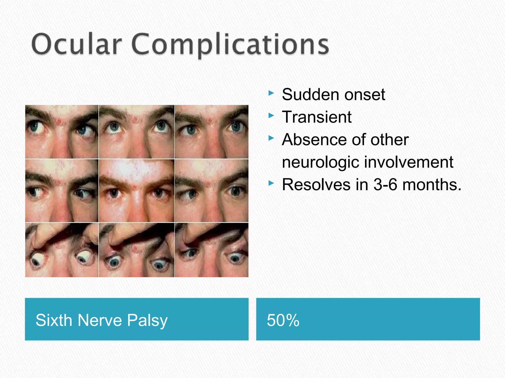 Sixth Nerve Palsy 50%
 Sudden onset
 Transient
 Absence of other
neurologic involvement
 Resolves in 3-6 months.
 