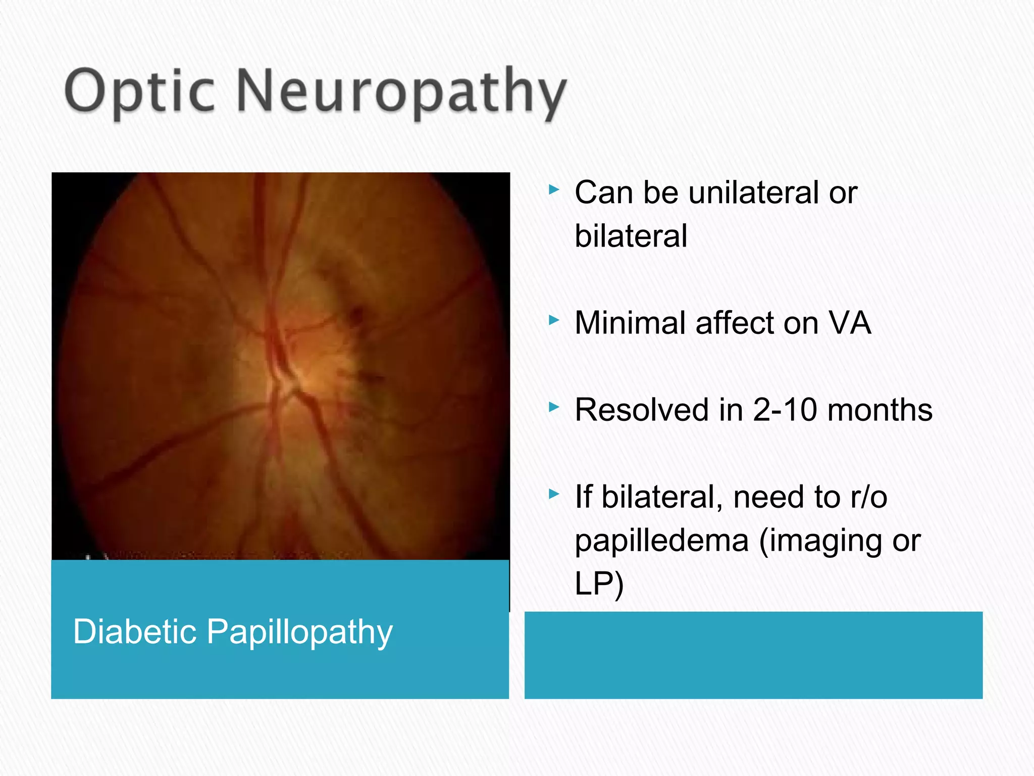 Diabetic Papillopathy
 Can be unilateral or
bilateral
 Minimal affect on VA
 Resolved in 2-10 months
 If bilateral, need to r/o
papilledema (imaging or
LP)
 