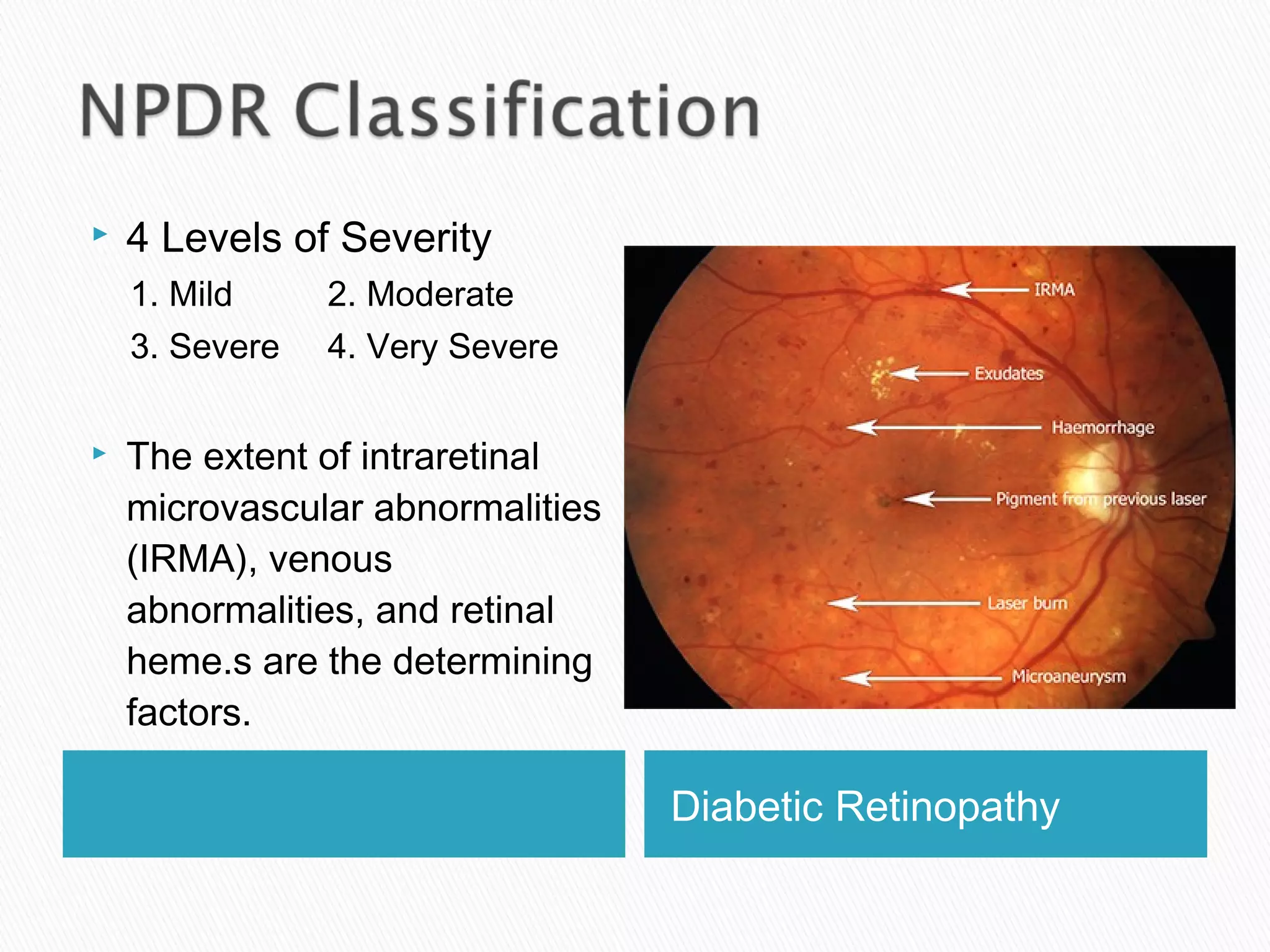 Diabetic Retinopathy
 4 Levels of Severity
1. Mild 2. Moderate
3. Severe 4. Very Severe
 The extent of intraretinal
microvascular abnormalities
(IRMA), venous
abnormalities, and retinal
heme.s are the determining
factors.
 