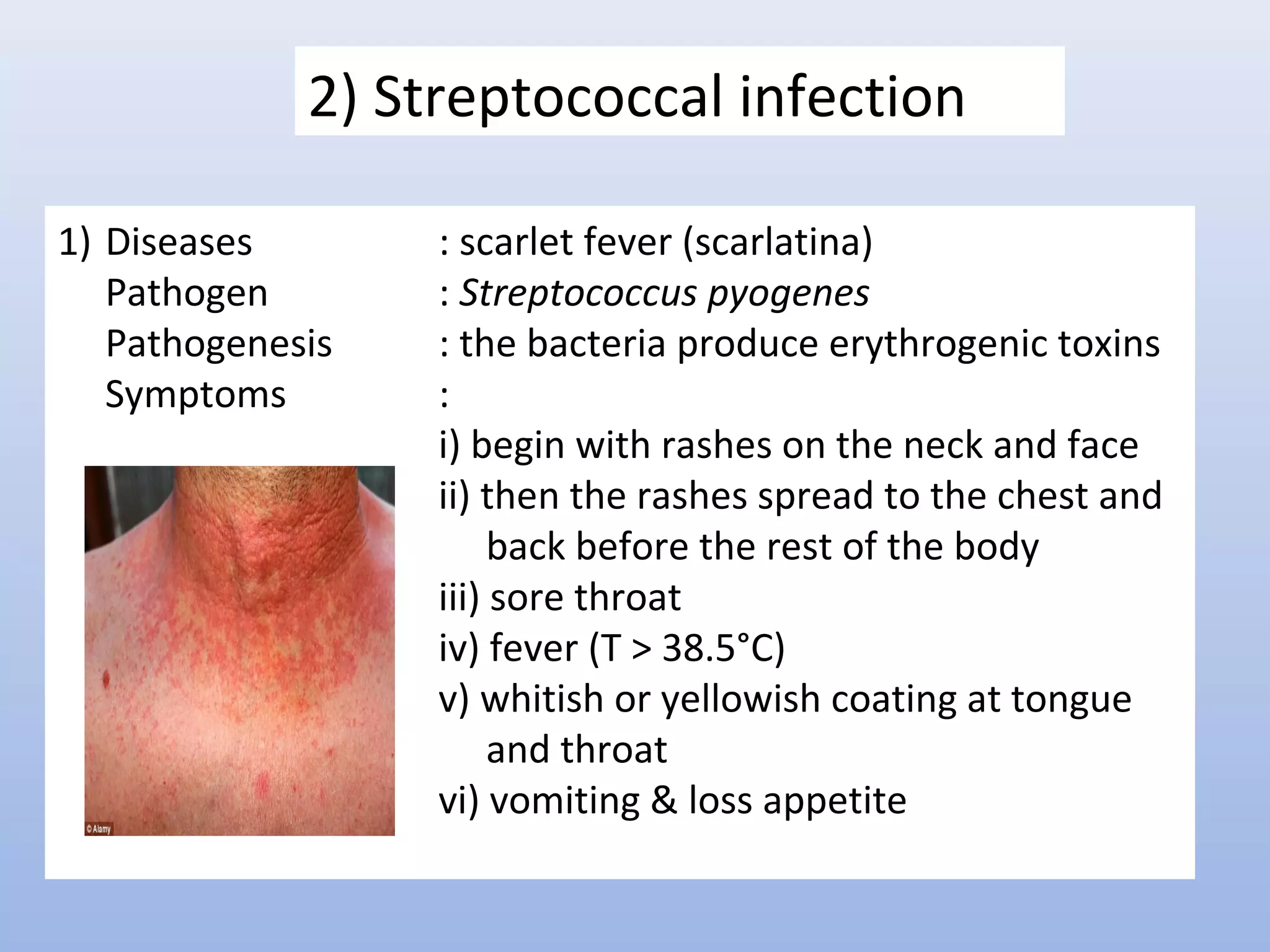 Lecture 3. diseases caused by bacterial infection | PPT