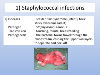 1) Staphylococcal infections 
2) Diseases : scalded skin syndrome (infant), toxic 
shock syndrome (adult) 
Pathogen : Staphylococcus aureus 
Transmission : touching, fomite, breastfeeding 
Pathogenesis : the bacterial toxins travel through the 
bloodstream, causing the upper skin layers 
to separate and peel off 
 