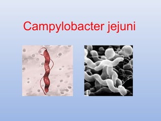 Campylobacter jejuni 
 