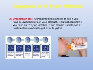 Diagnostic of H. Pylori Infection 
2) Urea breath test. A urea breath test checks to see if you 
have H. pylori bacteria in your stomach. This test can show if 
you have an H. pylori infection. It can also be used to see if 
treatment has worked to get rid of H. pylori. 
 