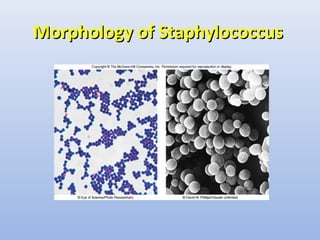 MMoorrpphhoollooggyy ooff SSttaapphhyyllooccooccccuuss 
 