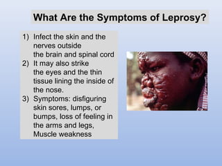 What Are the Symptoms of Leprosy? 
1) Infect the skin and the 
nerves outside 
the brain and spinal cord 
2) It may also strike 
the eyes and the thin 
tissue lining the inside of 
the nose. 
3) Symptoms: disfiguring 
skin sores, lumps, or 
bumps, loss of feeling in 
the arms and legs, 
Muscle weakness 
 