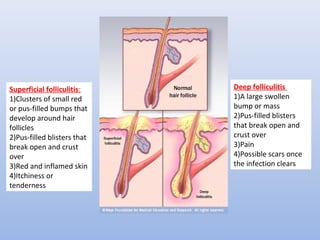 Superficial folliculitis: 
1)Clusters of small red 
or pus-filled bumps that 
develop around hair 
follicles 
2)Pus-filled blisters that 
break open and crust 
over 
3)Red and inflamed skin 
4)Itchiness or 
tenderness 
Deep folliculitis 
1)A large swollen 
bump or mass 
2)Pus-filled blisters 
that break open and 
crust over 
3)Pain 
4)Possible scars once 
the infection clears 
 