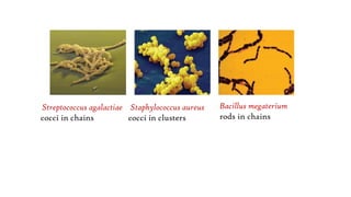Streptococcus agalactiae
cocci in chains
Staphylococcus aureus
cocci in clusters
Bacillus megaterium
rods in chains
 