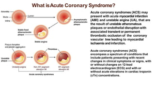 Lecture 3. Acute coronary syndromes — копия.pdf
