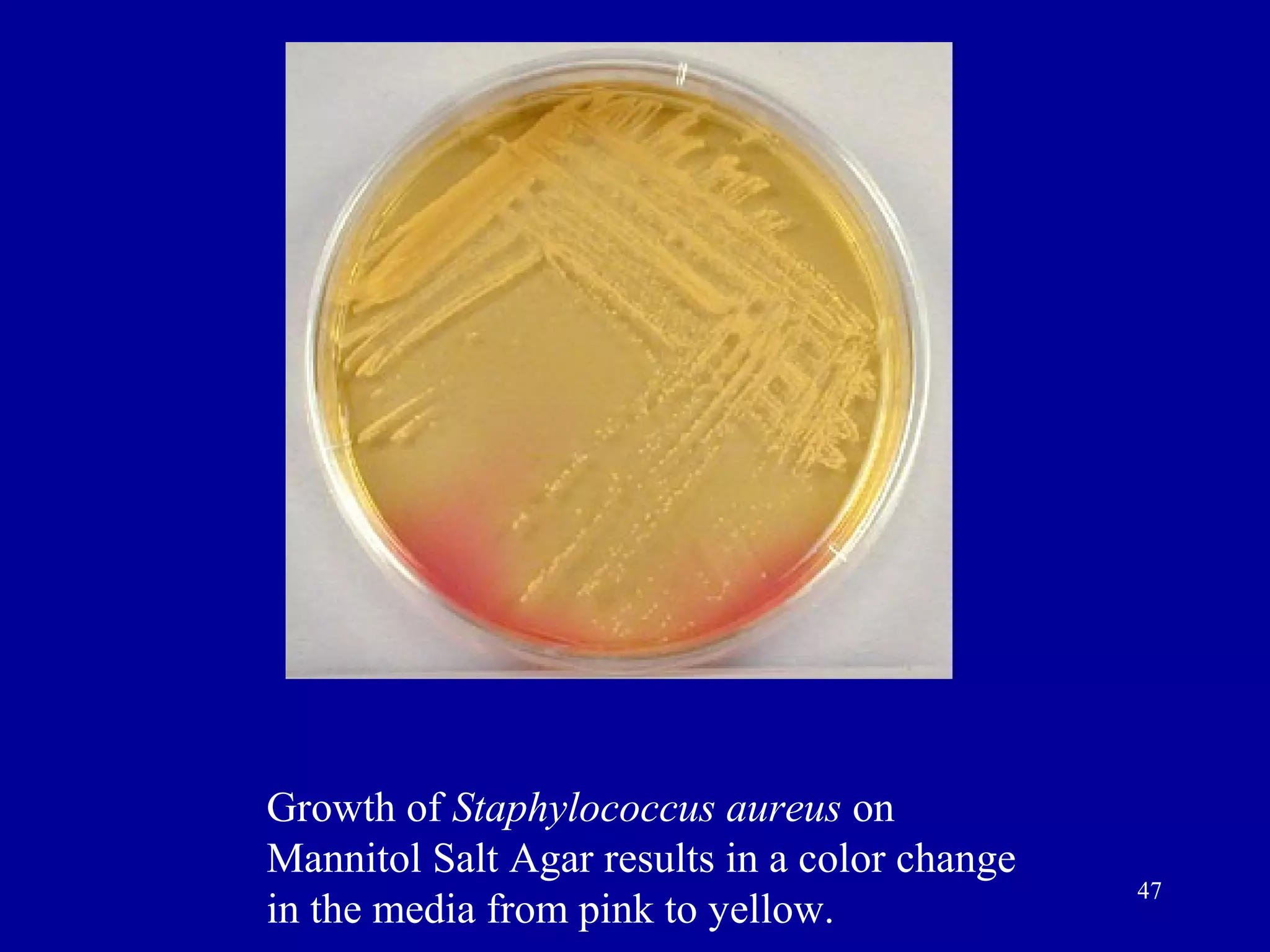 Growth of Staphylococcus aureus on
Mannitol Salt Agar results in a color change
                                               47
in the media from pink to yellow.
 