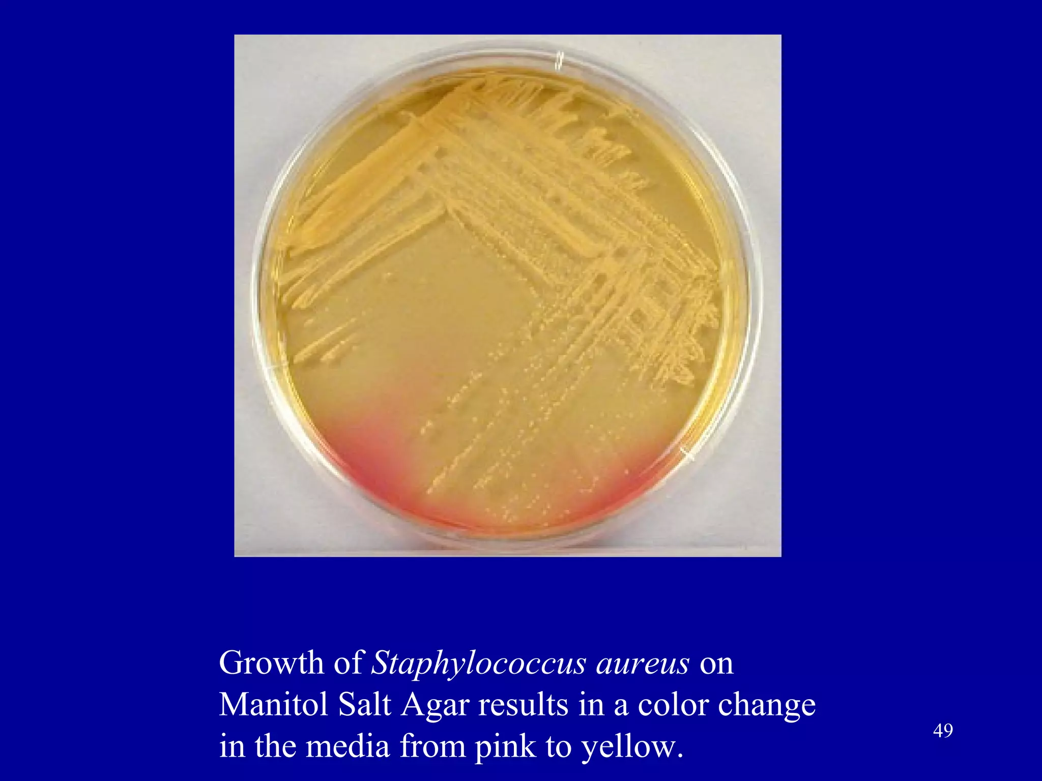 Growth of Staphylococcus aureus on
Manitol Salt Agar results in a color change
                                              49
in the media from pink to yellow.
 