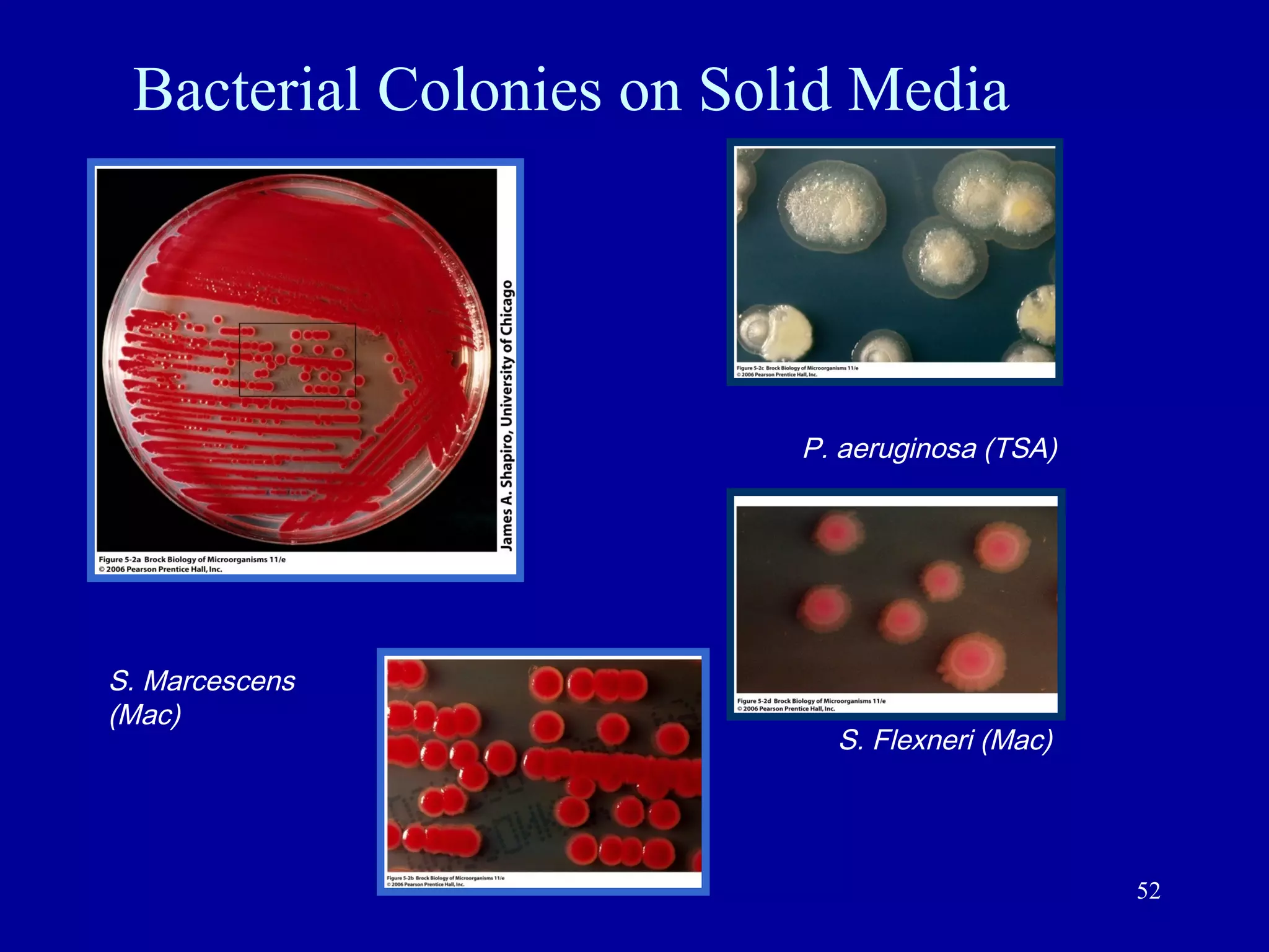 Bacterial Colonies on Solid Media




                          P. aeruginosa (TSA)




S. Marcescens
(Mac)
                            S. Flexneri (Mac)




                                                52
 