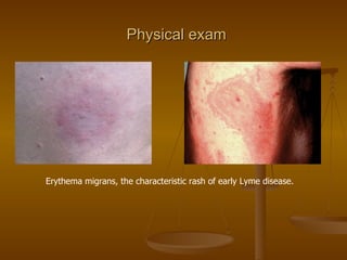 Exam Rash Lecture 3. epid. charact. of vector borne infections | PPT