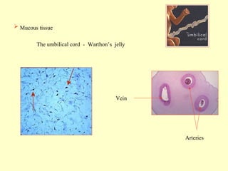  Mucous tissue
The umbilical cord - Warthon’s jelly

Vein

Arteries

 