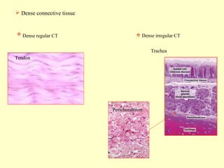  Dense connective tissue

 Dense regular CT

 Dense irregular CT
Trachea

Tendon

Perichondrium

 