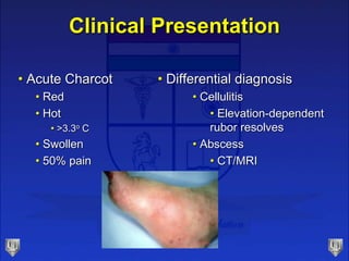 Clinical Presentation
• Differential diagnosis
• Cellulitis
• Elevation-dependent
rubor resolves
• Abscess
• CT/MRI
• Acute Charcot
• Red
• Hot
• >3.3o C
• Swollen
• 50% pain
 