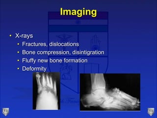 Imaging
• X-rays
• Fractures, dislocations
• Bone compression, disintigration
• Fluffy new bone formation
• Deformity
 