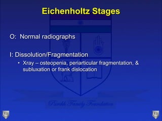 Eichenholtz Stages
O: Normal radiographs
I: Dissolution/Fragmentation
• Xray – osteopenia, periarticular fragmentation, &
subluxation or frank dislocation
 