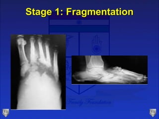 Stage 1: Fragmentation
 