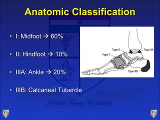 Anatomic Classification
• I: Midfoot  60%
• II: Hindfoot  10%
• IIIA: Ankle  20%
• IIIB: Calcaneal Tubercle
 