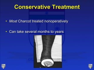 Conservative Treatment
• Most Charcot treated nonoperatively
• Can take several months to years
 