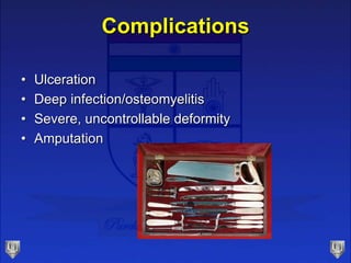 Complications
• Ulceration
• Deep infection/osteomyelitis
• Severe, uncontrollable deformity
• Amputation
 