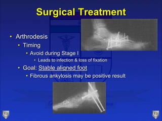Surgical Treatment
• Arthrodesis
• Timing
• Avoid during Stage I
• Leads to infection & loss of fixation
• Goal: Stable aligned foot
• Fibrous ankylosis may be positive result
 