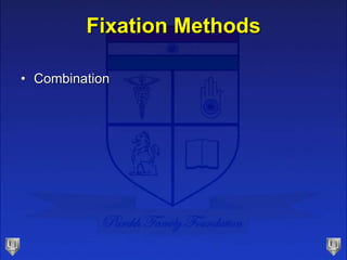 Fixation Methods
• Combination
 