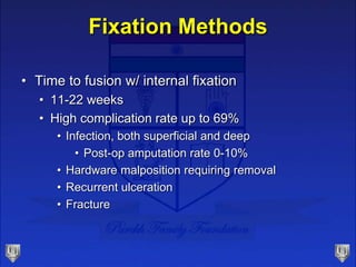 Fixation Methods
• Time to fusion w/ internal fixation
• 11-22 weeks
• High complication rate up to 69%
• Infection, both superficial and deep
• Post-op amputation rate 0-10%
• Hardware malposition requiring removal
• Recurrent ulceration
• Fracture
 