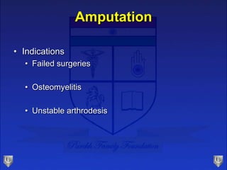 Amputation
• Indications
• Failed surgeries
• Osteomyelitis
• Unstable arthrodesis
 