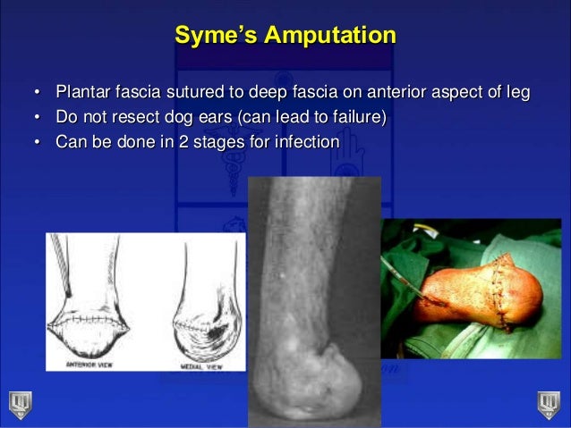 Cause Of Dog Ears Amputation Cause Of Dog Ears Amputation