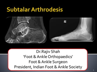 Dr.Rajiv Shah
‘Foot &Ankle Orthopaedics’
Foot & Ankle Surgeon
President, Indian Foot & Ankle Society
1
 