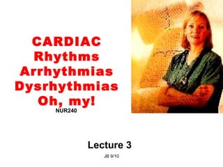 CARDIAC
  Rhythms
Arrhythmias
Dysrhythmias
   Oh, my!
    NUR240




             Lecture 3
                JB 9/10
 