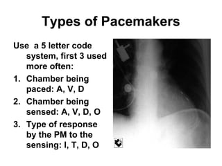 Lecture 3 cardiac rhythms | PPT
