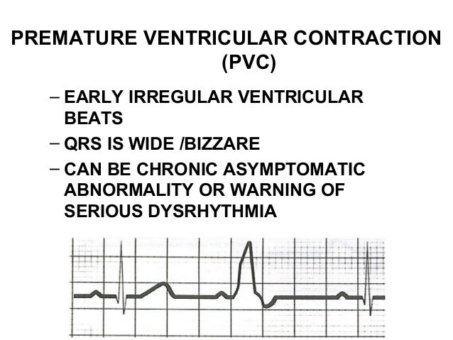 Lecture 3 cardiac rhythms