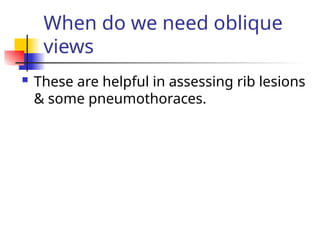 When do we need oblique
views
 These are helpful in assessing rib lesions
& some pneumothoraces.
 