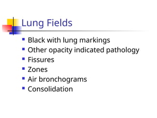  Black with lung markings
 Other opacity indicated pathology
 Fissures
 Zones
 Air bronchograms
 Consolidation
Lung Fields
 
