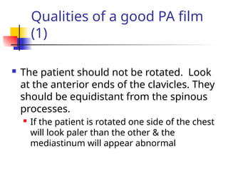 Qualities of a good PA film
(1)
 The patient should not be rotated. Look
at the anterior ends of the clavicles. They
should be equidistant from the spinous
processes.
 If the patient is rotated one side of the chest
will look paler than the other & the
mediastinum will appear abnormal
 