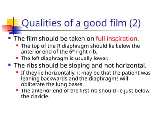 Qualities of a good film (2)
 The film should be taken on full inspiration.
 The top of the R diaphragm should lie below the
anterior end of the 6th
right rib.
 The left diaphragm is usually lower.
 The ribs should be sloping and not horizontal.
 If they lie horizontally, it may be that the patient was
leaning backwards and the diaphragms will
obliterate the lung bases.
 The anterior end of the first rib should lie just below
the clavicle.
 