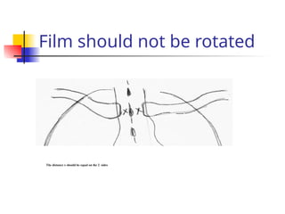 Film should not be rotated
The distance x should be equal on the 2 sides
 