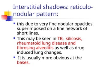 Interstitial shadows: reticulo-
nodular pattern:
 this due to very fine nodular opacities
superimposed on a fine network of
short lines.
 This may be seen in TB, silicosis,
rheumatoid lung disease and
fibrosing alveolitis as well as drug
induced lung changes.
 It is usually more obvious at the
bases.
 