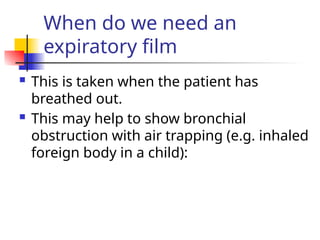 When do we need an
expiratory film
 This is taken when the patient has
breathed out.
 This may help to show bronchial
obstruction with air trapping (e.g. inhaled
foreign body in a child):
 