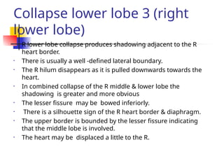 Collapse lower lobe 3 (right
lower lobe)
• R lower lobe collapse produces shadowing adjacent to the R
heart border.
• There is usually a well -defined lateral boundary.
• The R hilum disappears as it is pulled downwards towards the
heart.
• In combined collapse of the R middle & lower lobe the
shadowing is greater and more obvious
• The lesser fissure may be bowed inferiorly.
• There is a silhouette sign of the R heart border & diaphragm.
• The upper border is bounded by the lesser fissure indicating
that the middle lobe is involved.
• The heart may be displaced a little to the R.
 