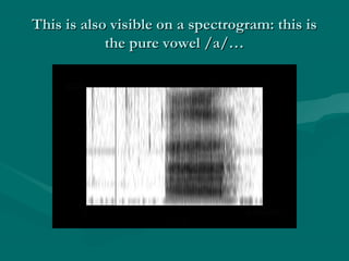 This is also visible on a spectrogram: this isThis is also visible on a spectrogram: this is
the pure vowel /a/…the pure vowel /a/…
 