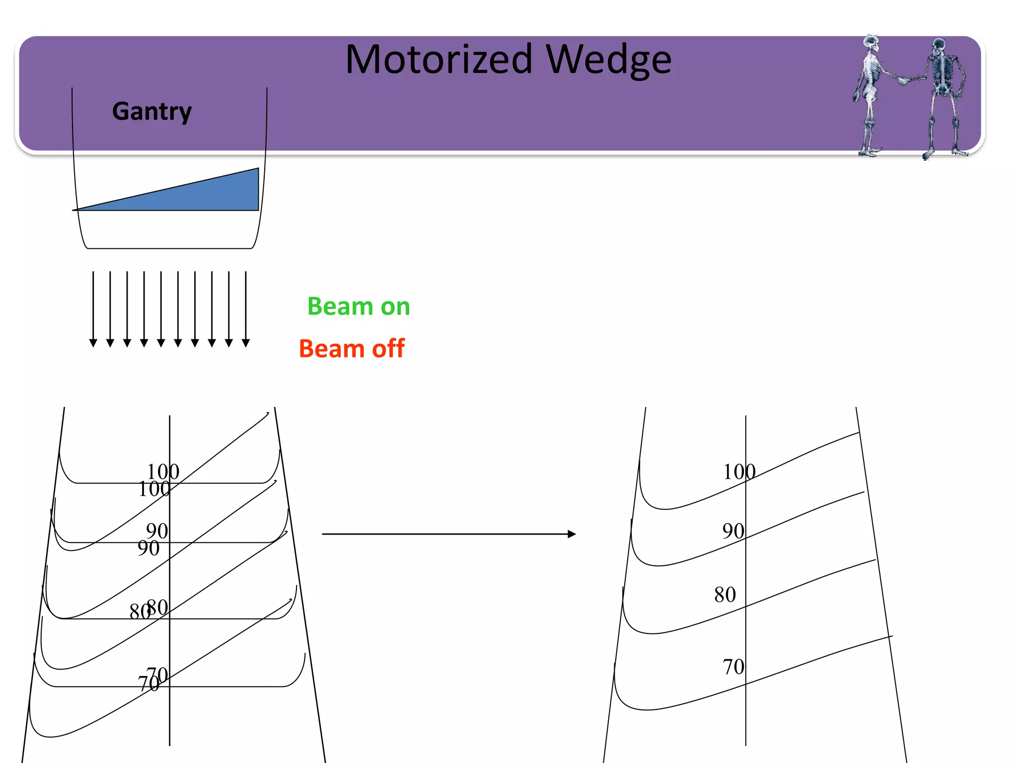 Motorized Wedge
100
90
80
70
100
90
80
70
Gantry
Beam on
100
90
80
70
Beam off
 