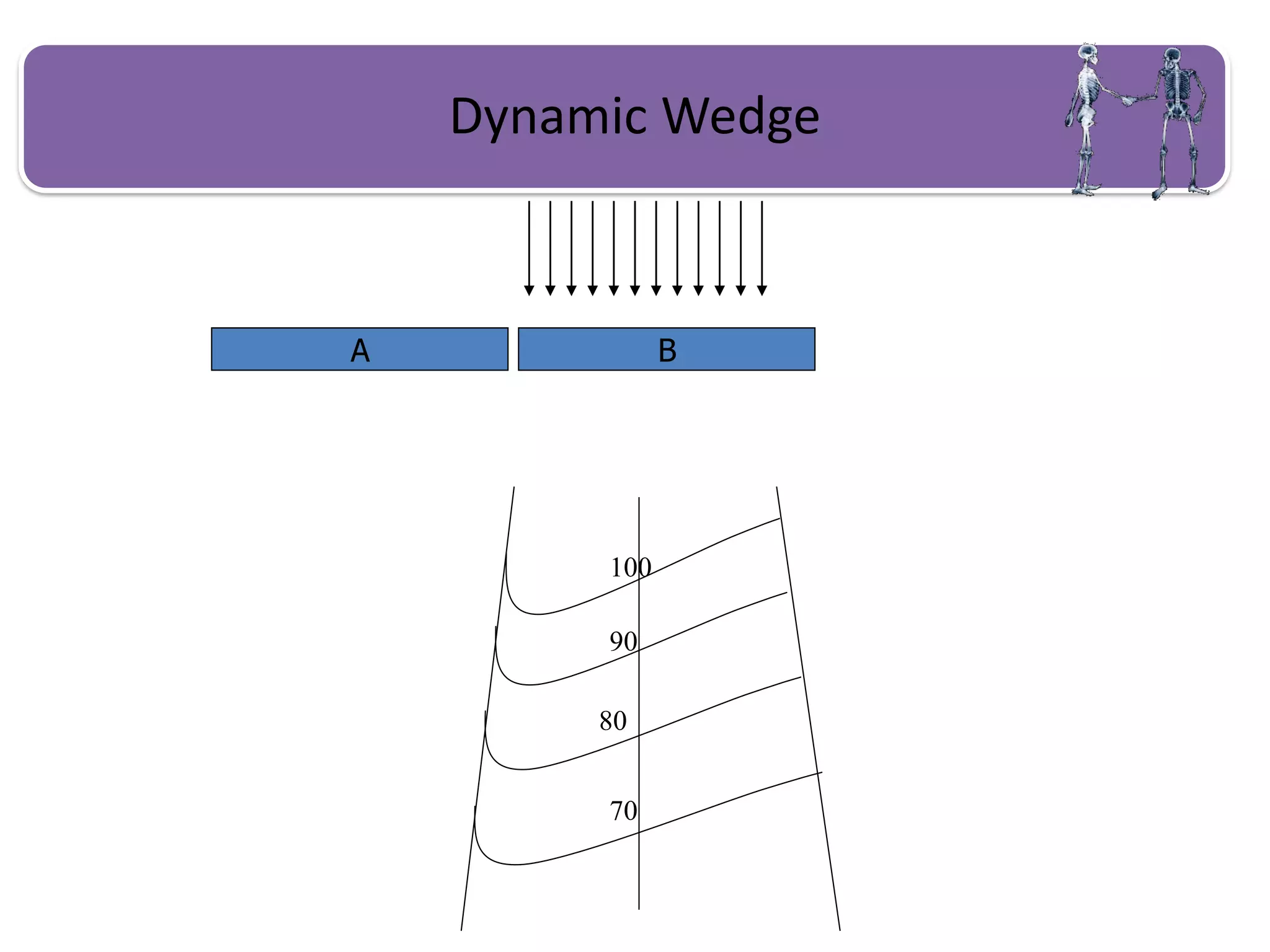 Dynamic Wedge
B
A
100
90
80
70
 