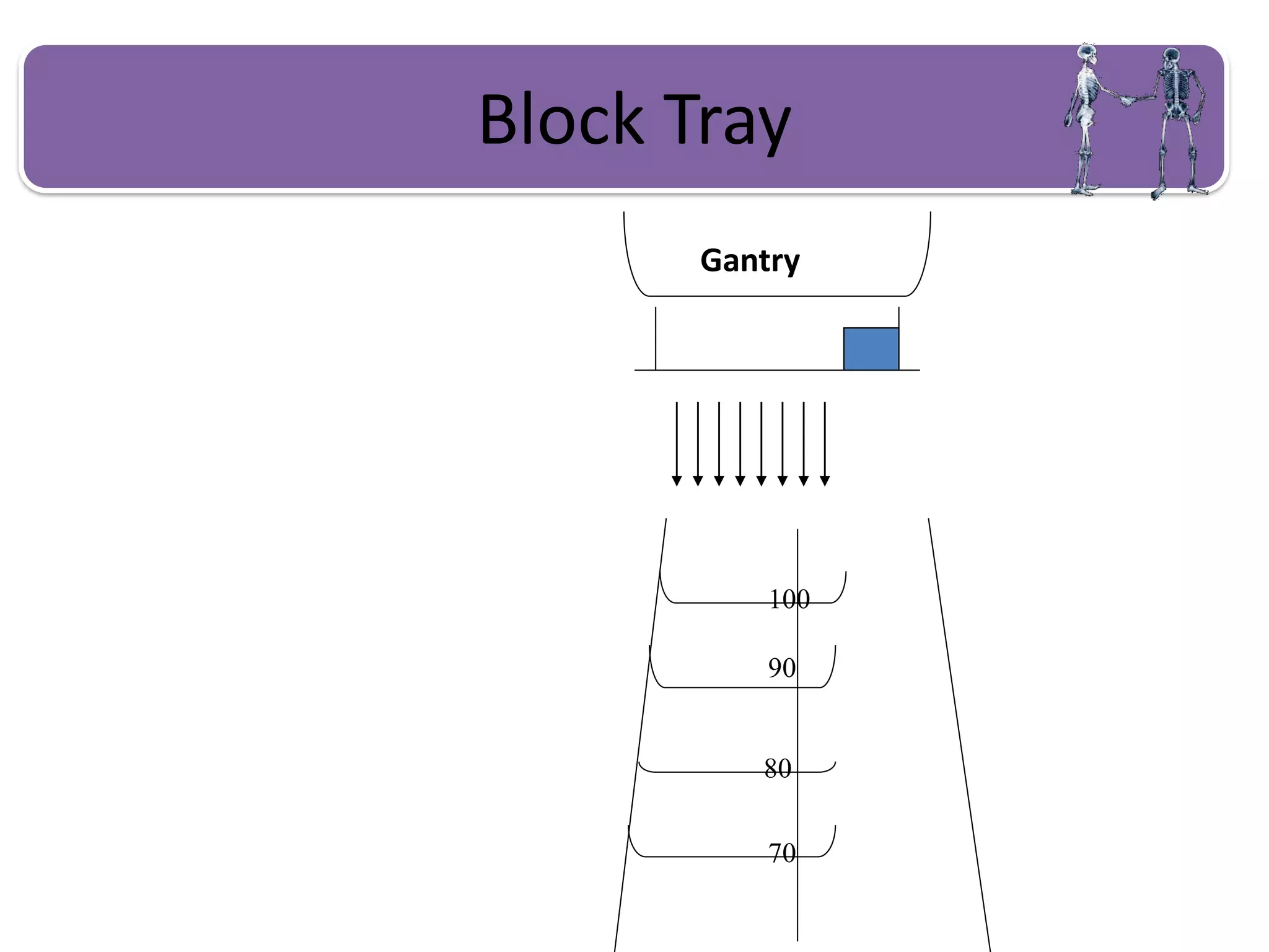 Block Tray
Gantry
100
90
80
70
 