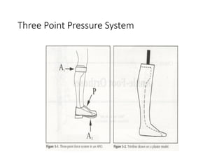 lecture#3 lower limb Orthoses.pptx kmu ipmr | PPTX