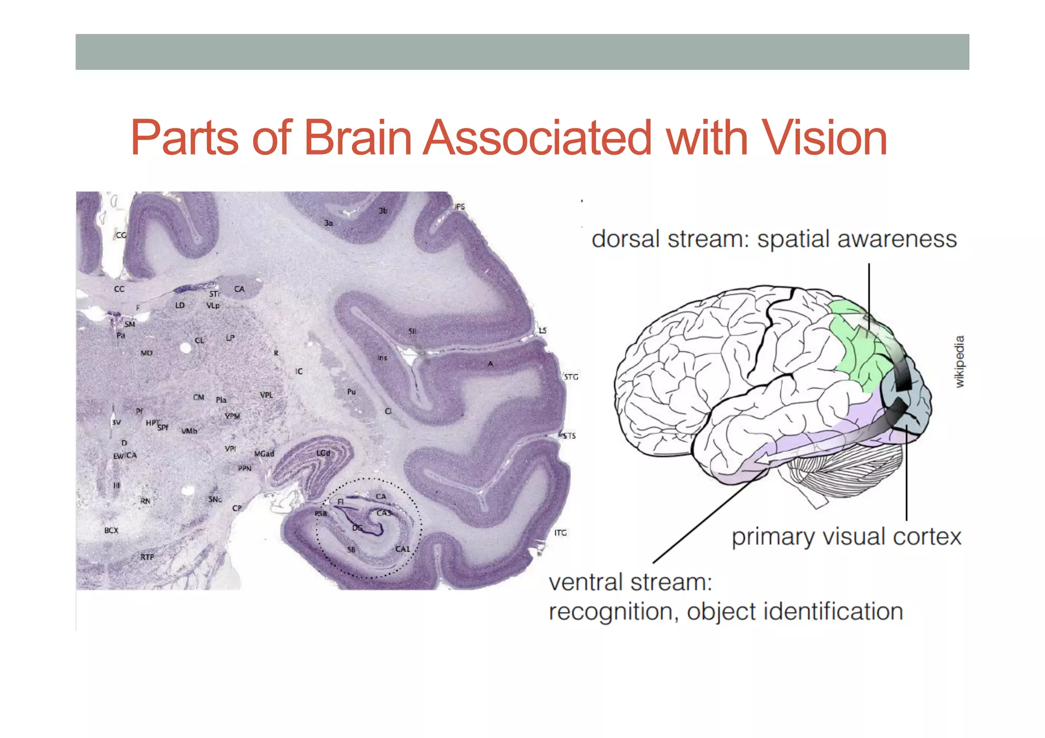 Parts of Brain Associated with Vision
 