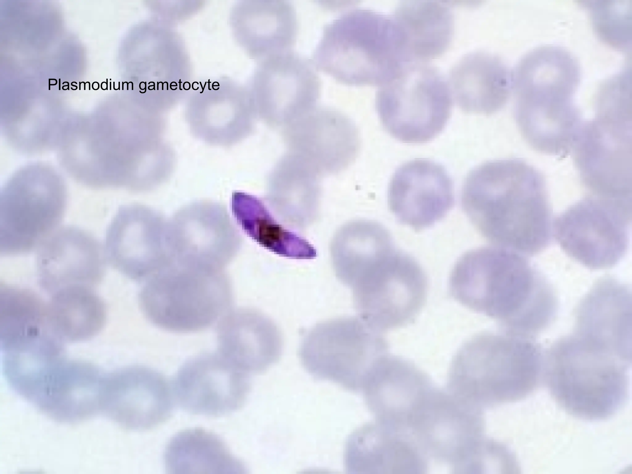 Plasmodium gametocyte
 